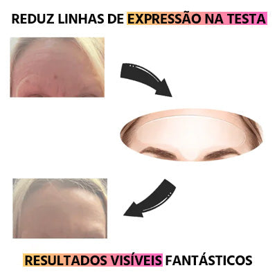 Adesivos de Silicone Anti Rugas Reutilizável Mega Certo