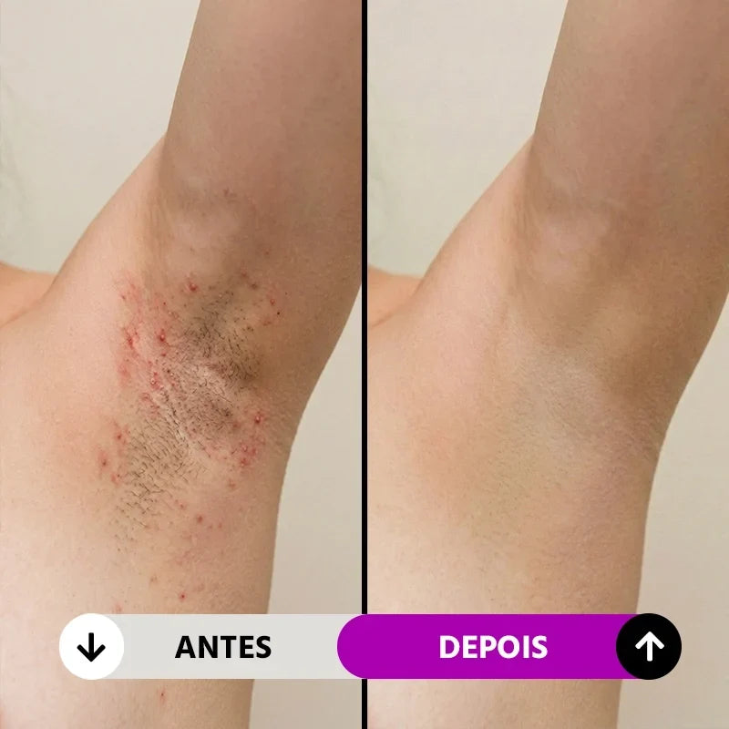 Depilador Elétrico Feminino 4 em 1 Velumi Mega Certo