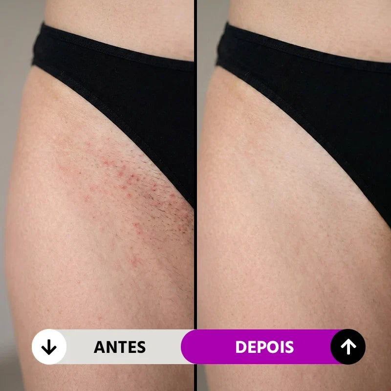Depilador Elétrico Feminino 4 em 1 Velumi Mega Certo