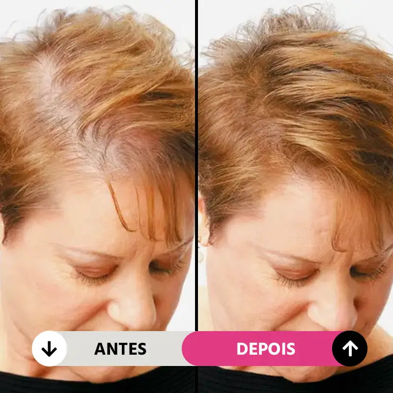 Preenchimento de Maquiagem Capilar à Prova D'Água Natural Unissex FillHair Mega Certo